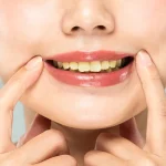 Kenali Kebiasaan Harian Yang Membuat Warna Gigi Menguning