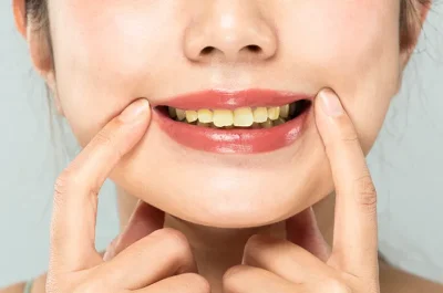 Kenali Kebiasaan Harian Yang Membuat Warna Gigi Menguning
