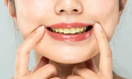 Kenali Kebiasaan Harian Yang Membuat Warna Gigi Menguning