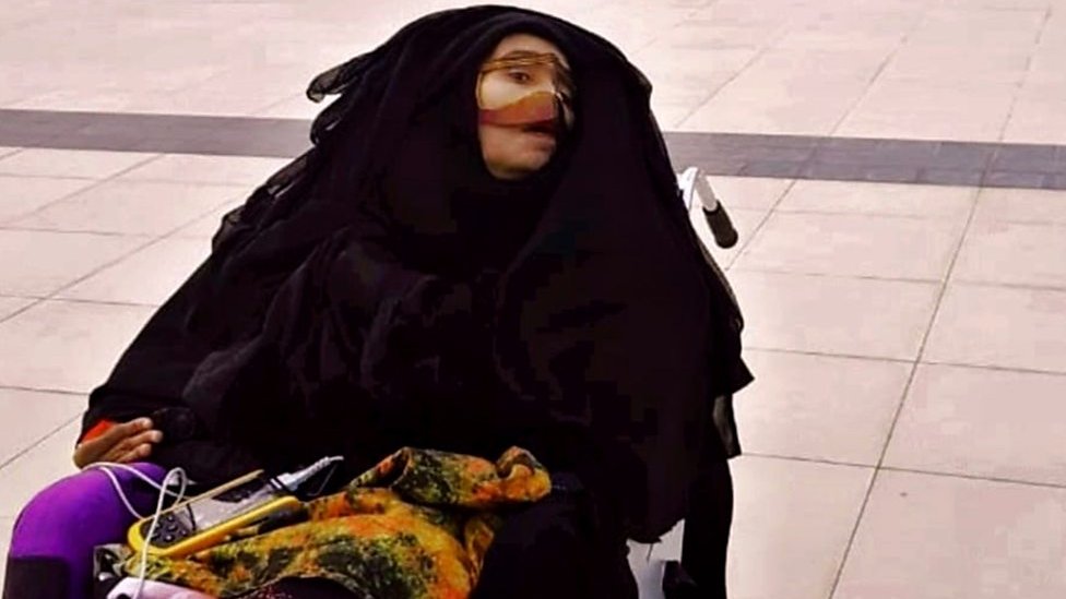 Tidur 27 Tahun, Munira Abdulla Akhirnya Bangun Dari Koma