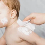 Tips Atasi Biang Keringat Si Kecil Dengan Bedak Ini