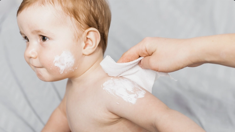 Tips Atasi Biang Keringat Si Kecil Dengan Bedak Ini